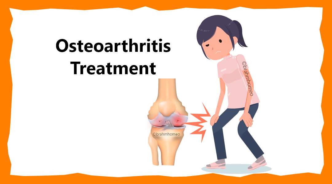 Osteoarthritis (OA)