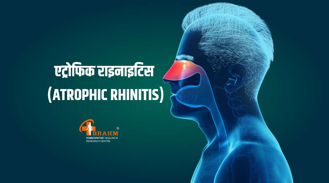 atrophic rhinitis treatment in homeopathy