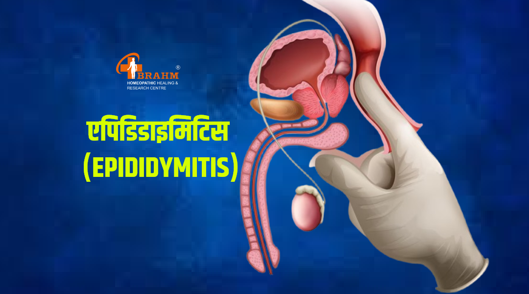 epididymitis treatment in homeopathy