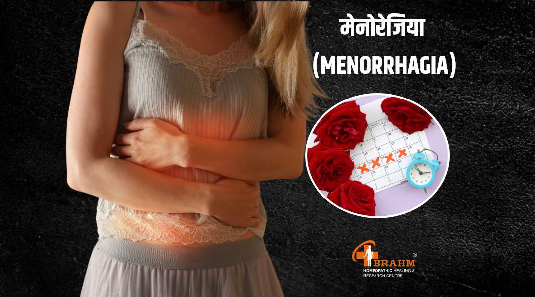 Menorrhagia ka homeopathy me ilaaj