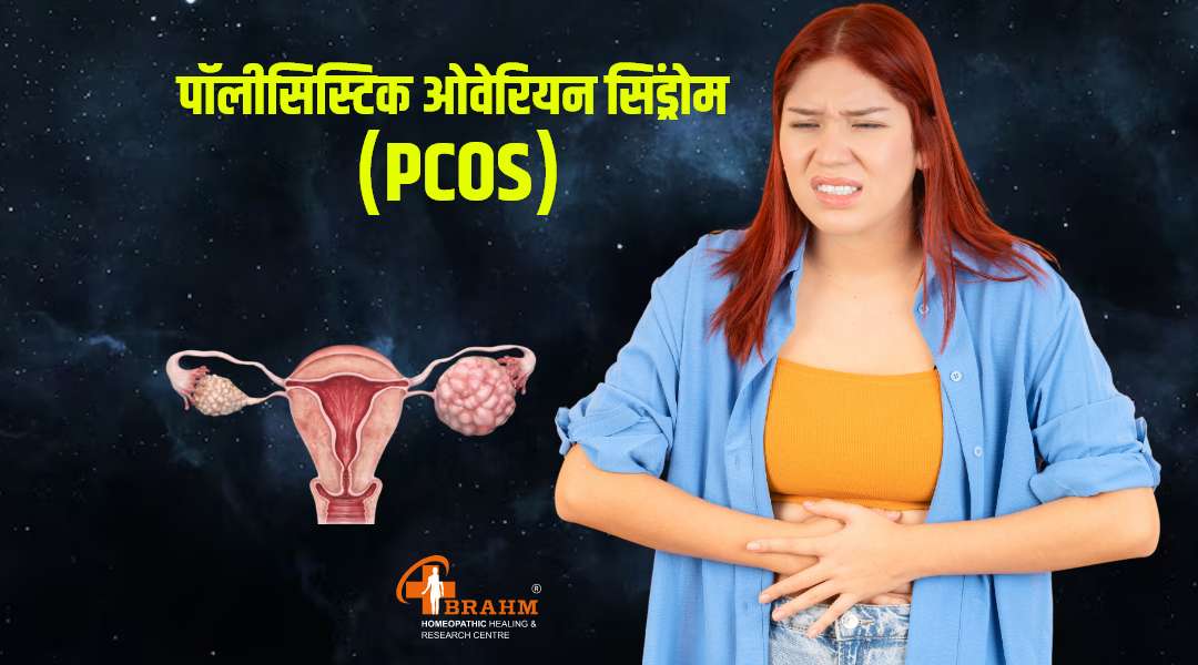 homeopathy me pcos ka ilaaj