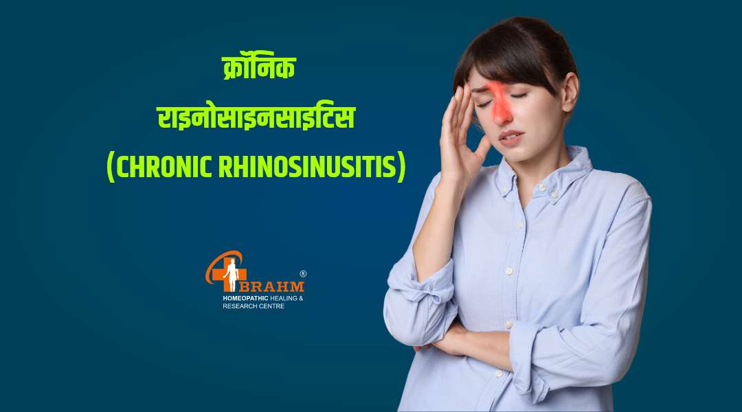 chronic rhinosinusitis treatment for homeopathy