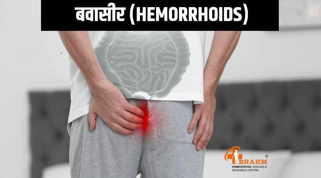 Hemorrhoids ka homeopathic me ilaaj