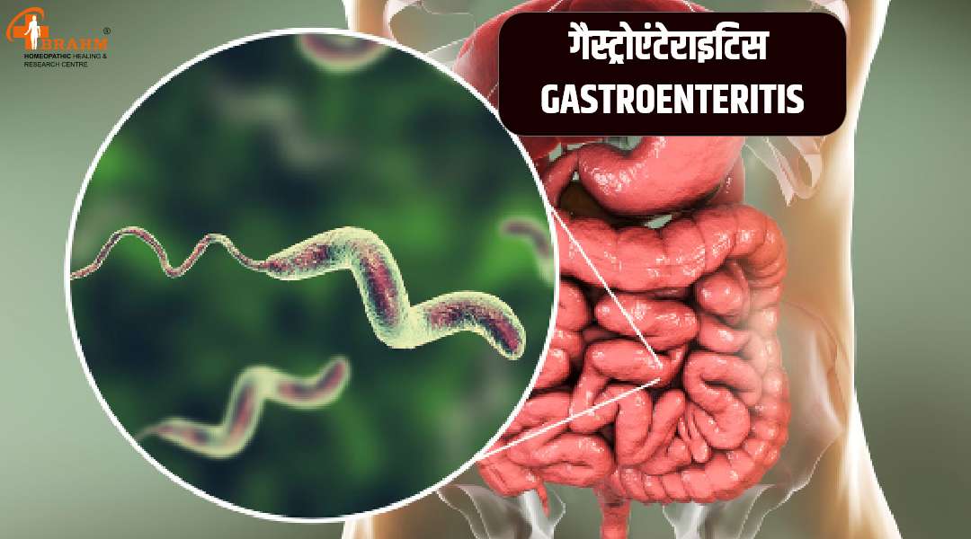 homeopathic me gas ka ilaj