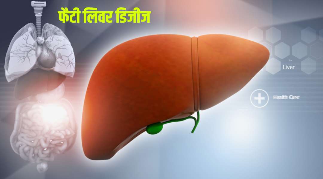 fatty liver treatment homeopathy in hindi
