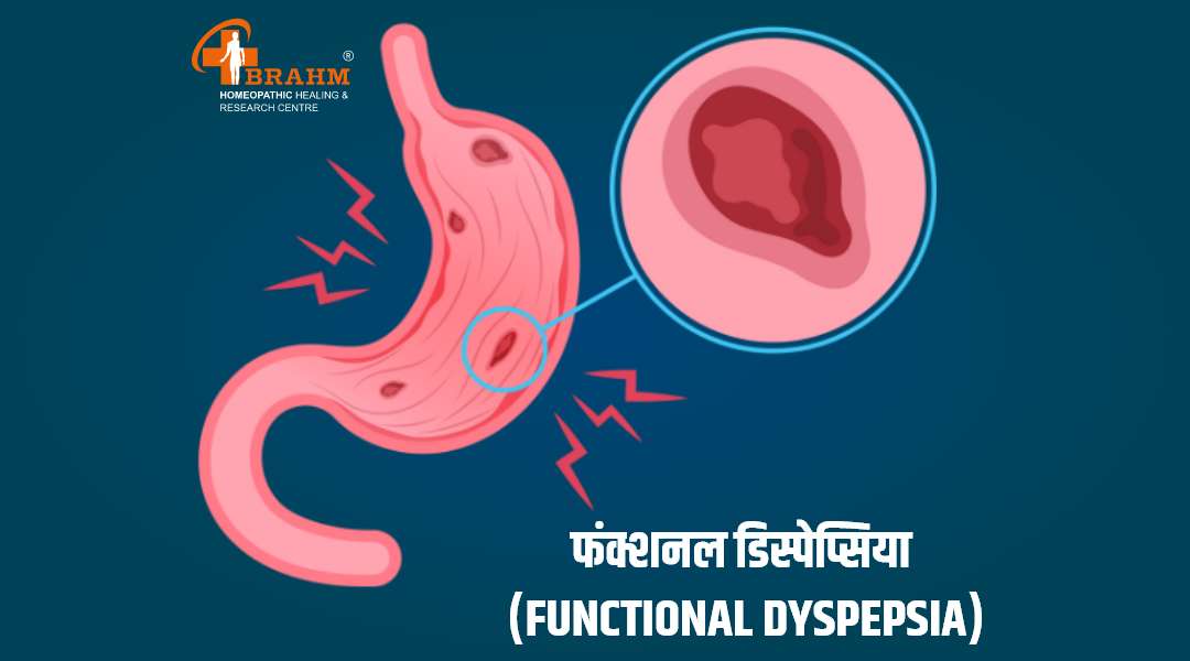 functional dyspepsia treatment in homeopathy