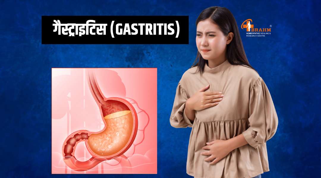 Gastritis treatment in homeopathic 