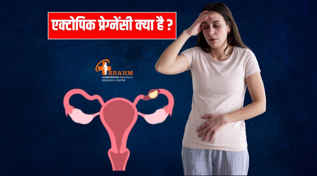 ectopic pregnancy treatment in homeopathy