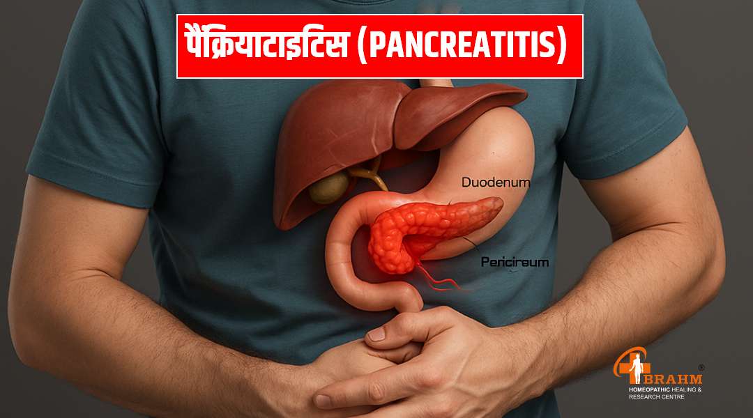 pancreatitis bimari ka homeopathy me ilaaj