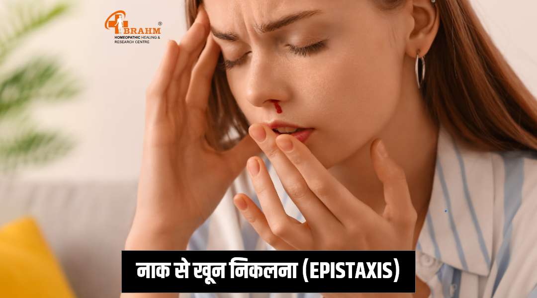 naak se khoon aana ka homeopathy me ilaaj
