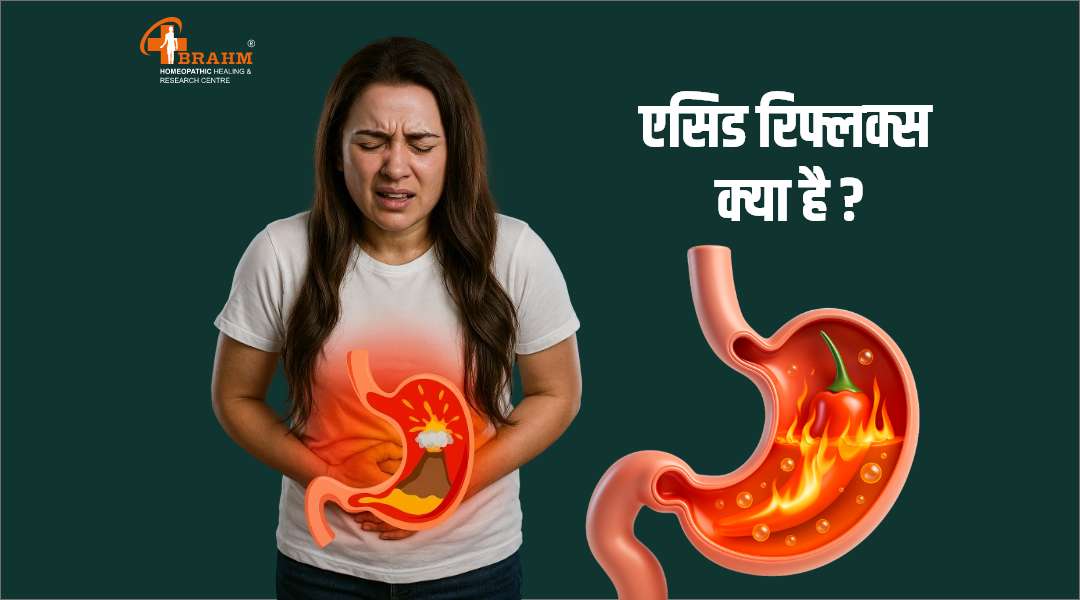acid reflux treatment in homeopathy