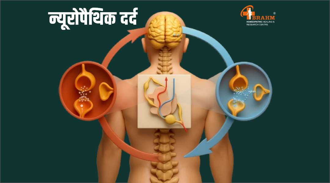 neuropathic dard  kya hota hai | homeopathy me neuropathic dard ka ilaaj