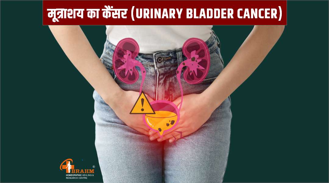 urinary bladder cancer kya hai  | urinary bladder ka homeopathy me ilaaj