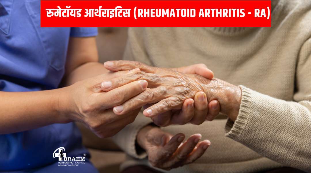 Rheumatoid Arthritis treatment in homeopathy