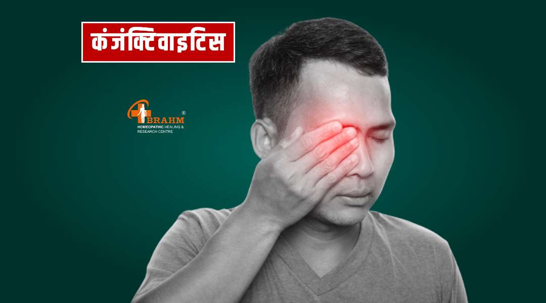 Allergic conjunctivitis treatment in homeopathy
