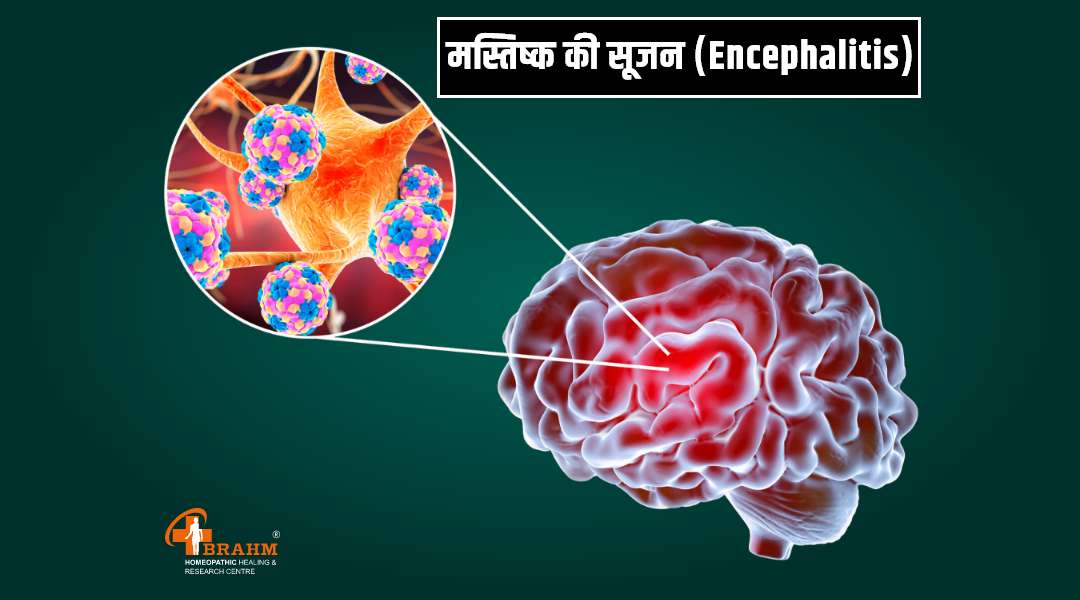 Encephalitis treatment in homeopathic