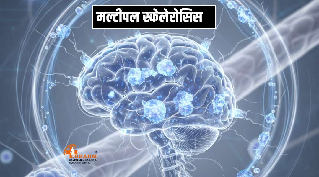 multiple sclerosis treatment in homeopathic