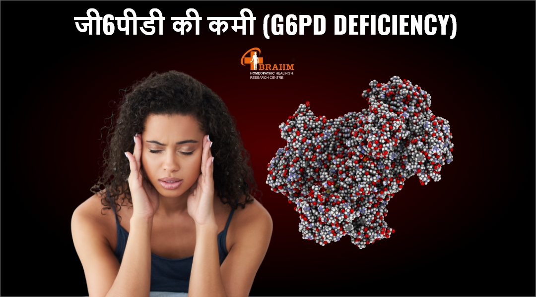 G6PD Deficiency ki kmi karan laksan upchaar