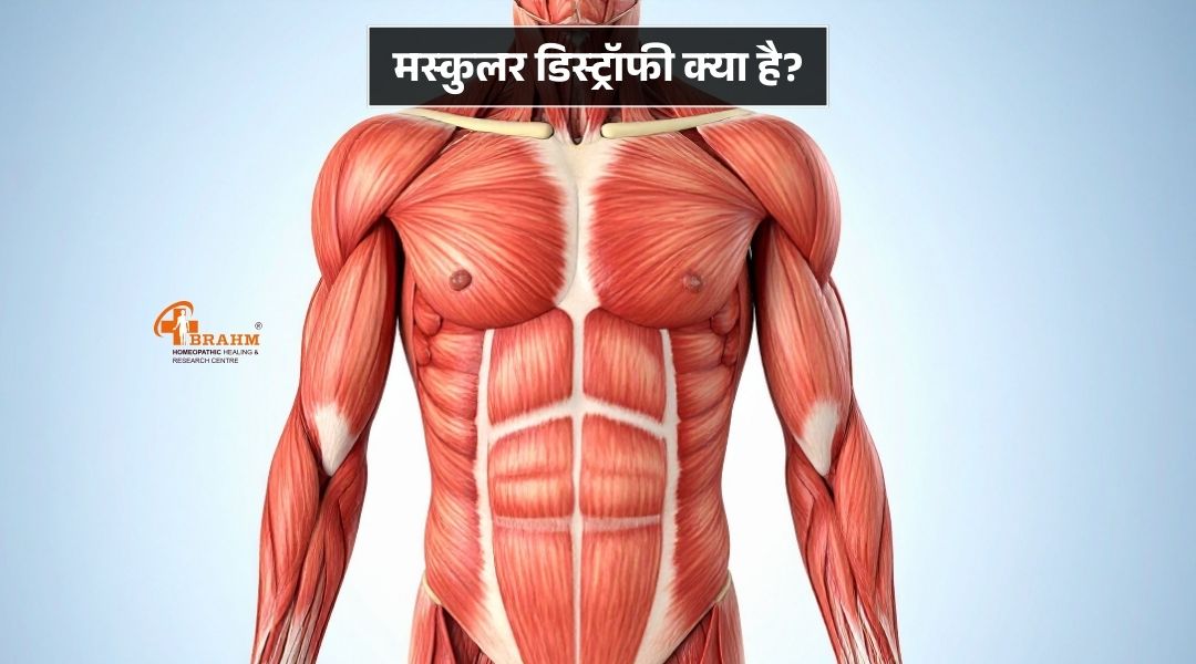 muscular dystrophy treatment in homeopathy 