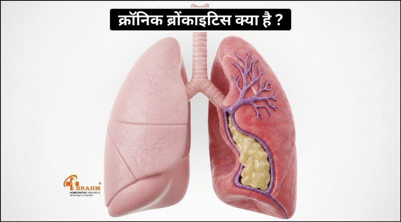 chronic bronchitis kya hai or kyu hota hai?