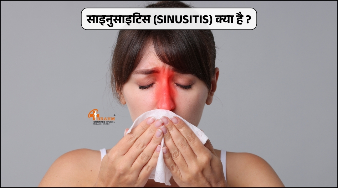 homeopathy me Sinusitis bimari ka ilaj?