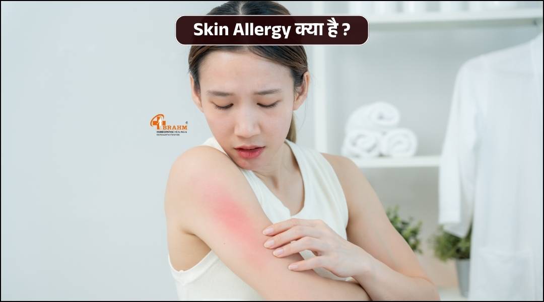 Skin Allergy kya hai? or kaise hota hai?