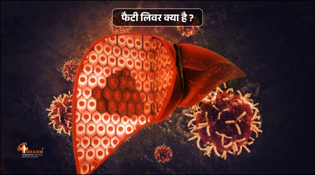 fatty liver kya hai or homeopathy me kya ilaj hai?