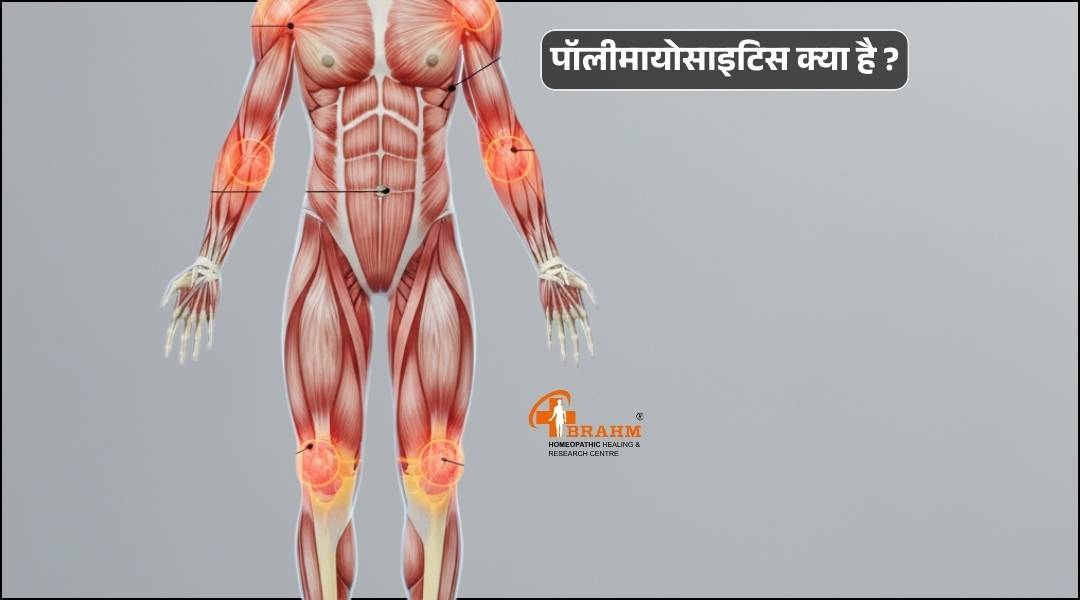 Polymyositis kya hai or kyu hota hai?