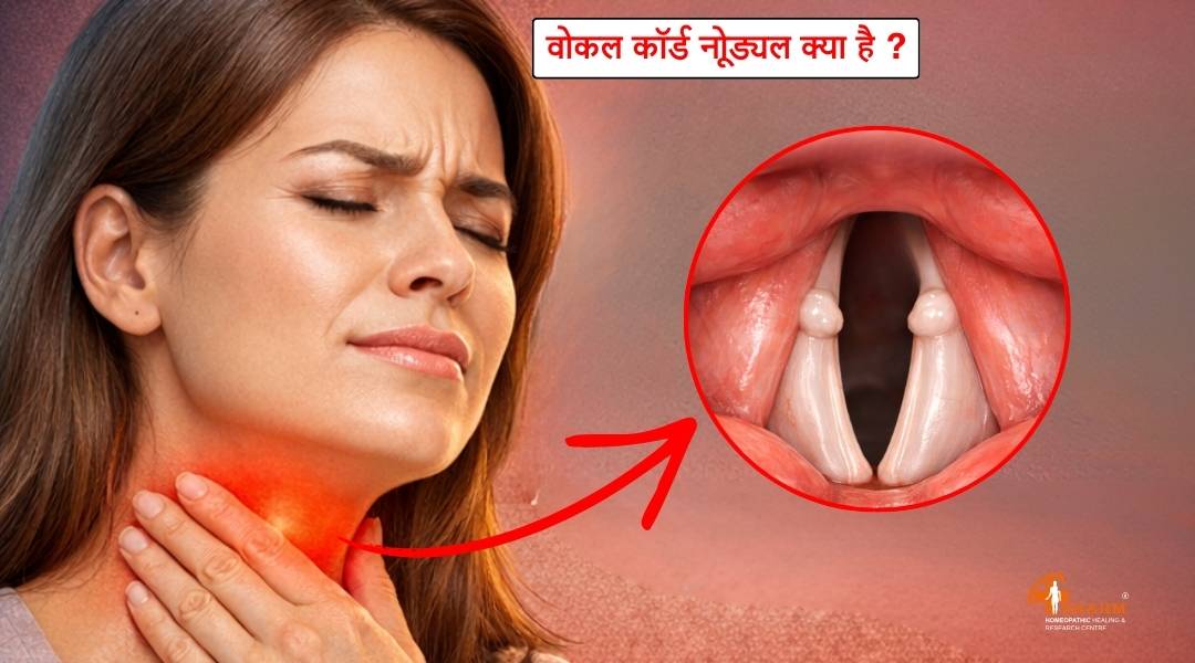 Vocal Cord Nodule kya hai? or kaise hota hai?