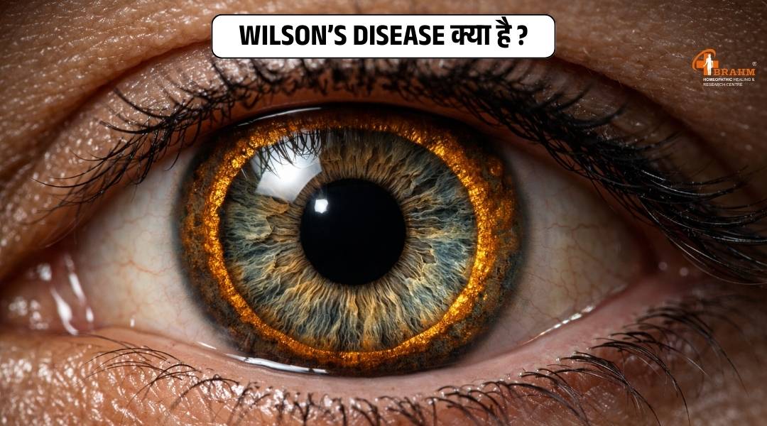 Wilson’s rog kya hai or kaise hota hai?