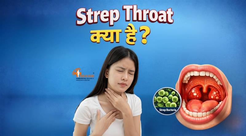 Strep Throat kya hai or kaise hota hai?