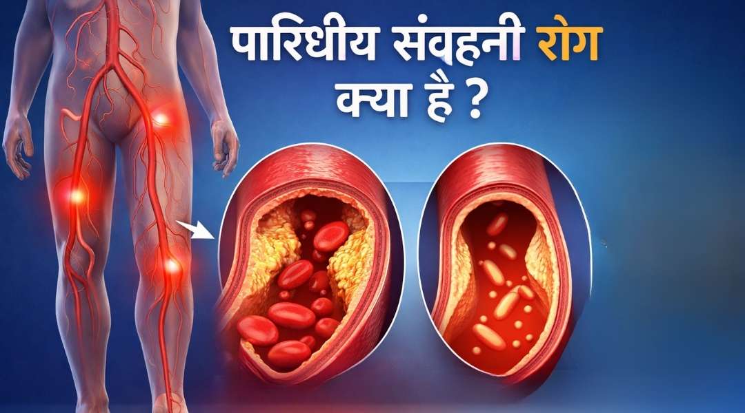 Peripheral Vascular Disease ka homeopathic me ilaj