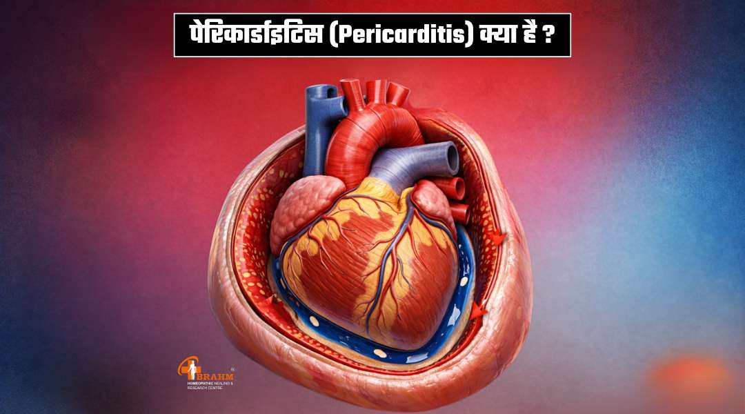 Pericarditis kya hai? or kyu hota hai?