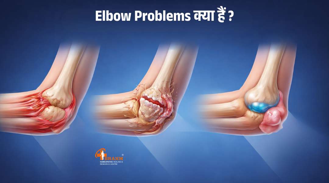 Elbow Problems kaise or kyu hoti hai?