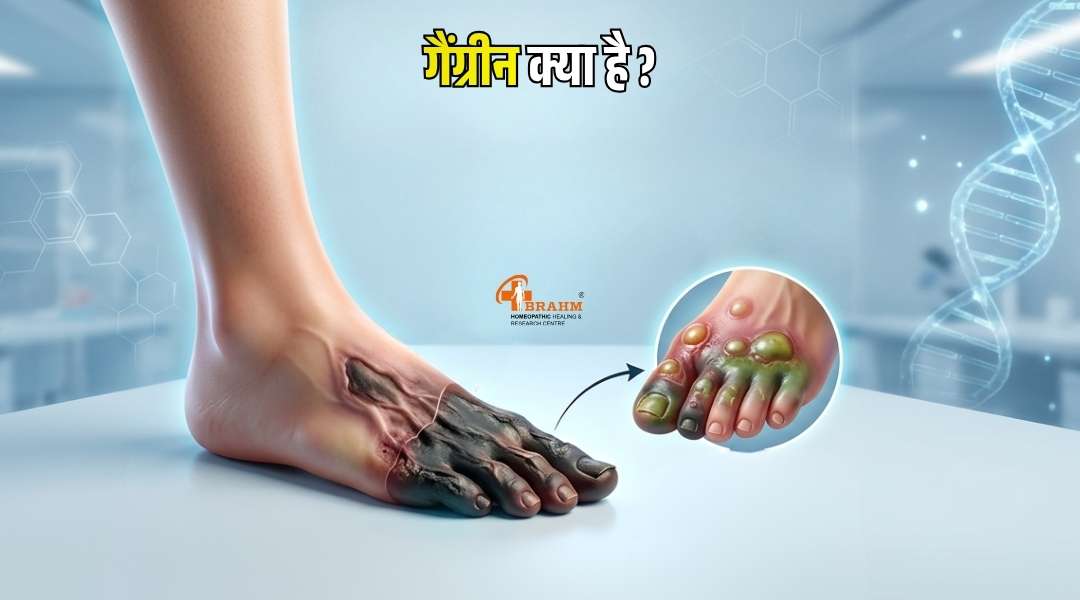 Gangrene kya hai ? kaise failta hai?