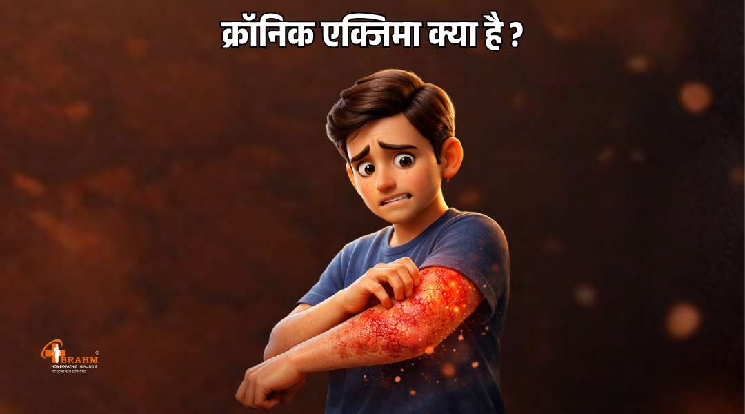 chronic eczema kya hota hai?or kaise hota hai?