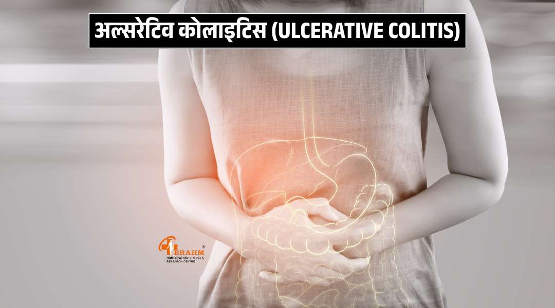 Ulcerative Colitis kya hai? or kaise hota hai?