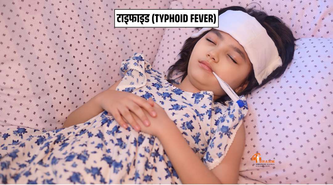 Typhoid Fever kya hai?or kaise hota hai?