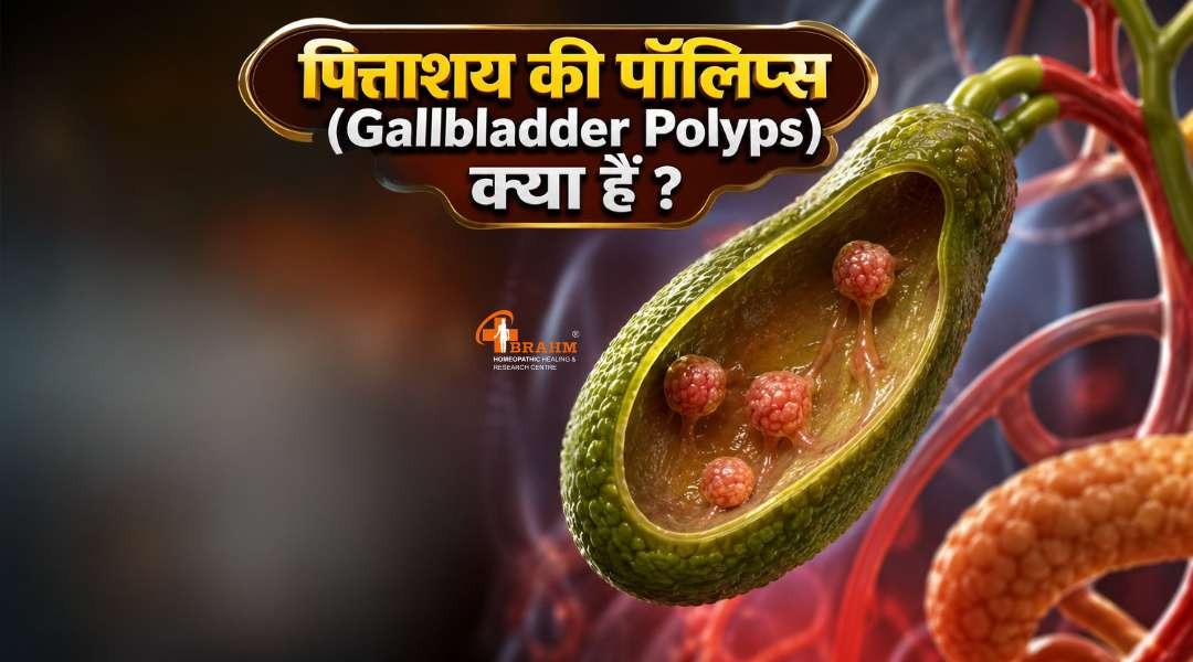 Gallbladder Polyps kya hai? aur uske kitne stage hote hai?