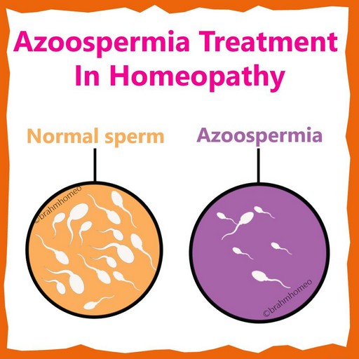 Azospermia