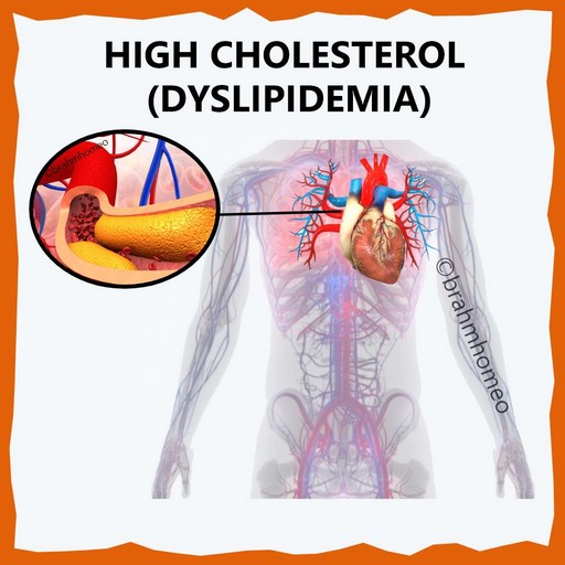 HIGH-CHOLESTEROL-(DISLIPIMIDIA)-TREATMENT-IN-HOMEOPATHY