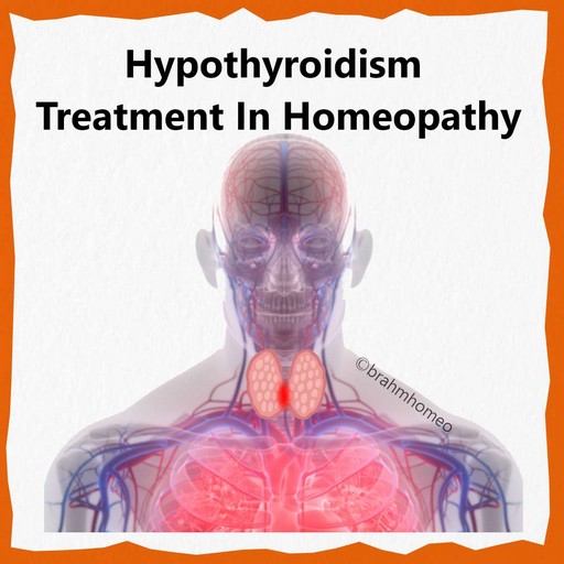 Hyperthyroidism-treatment-in-homeopathy