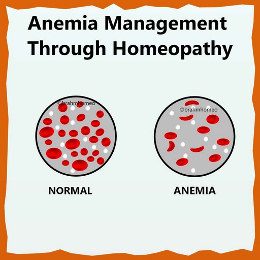 anaemia-management-through-homeopathy