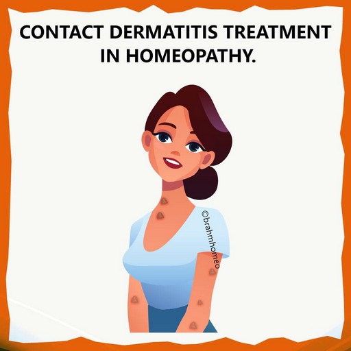 contact-dermatitis-treatment-in-homeopathy