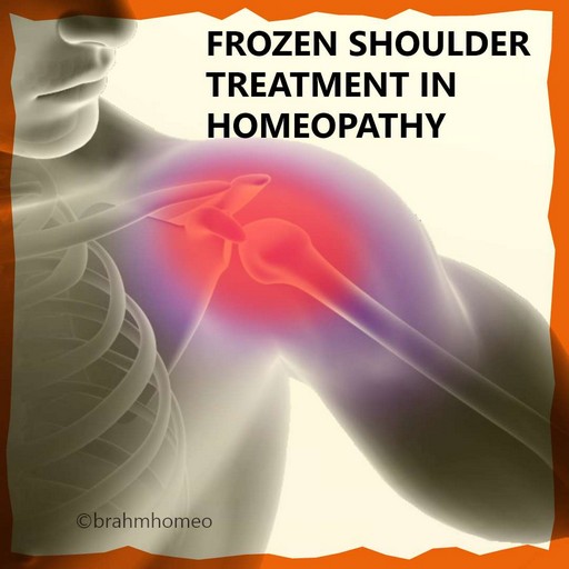 frozen-shoulder-treatment-in-homeopathy