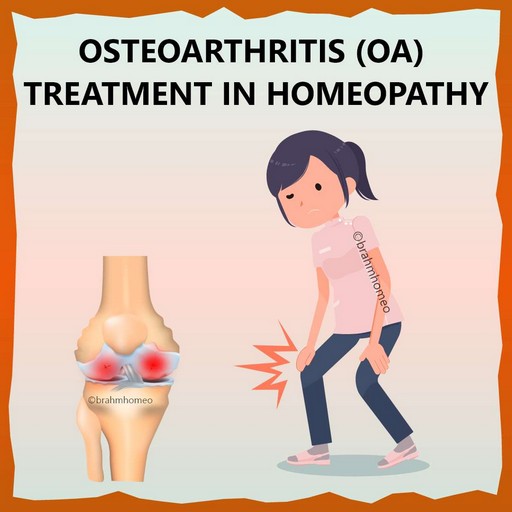 osteoarthritis-(oa)-treatment-in-homeopathy