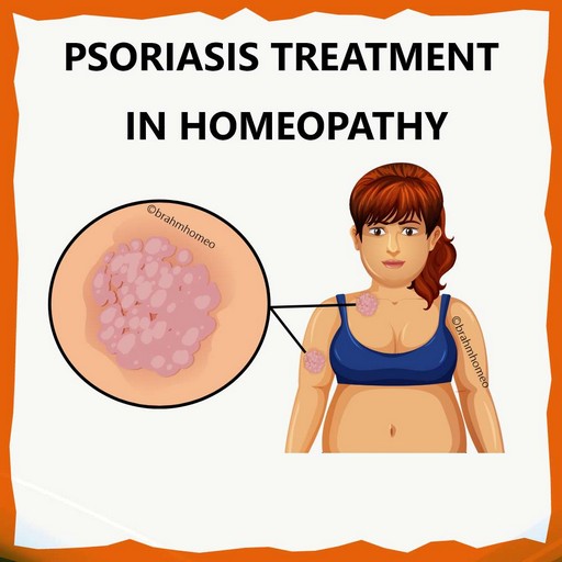 psoriasis-treatment-in-homeopathy