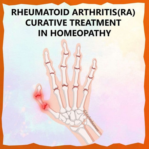 rheumatoid-arthriti-treatment-in-homeopathy