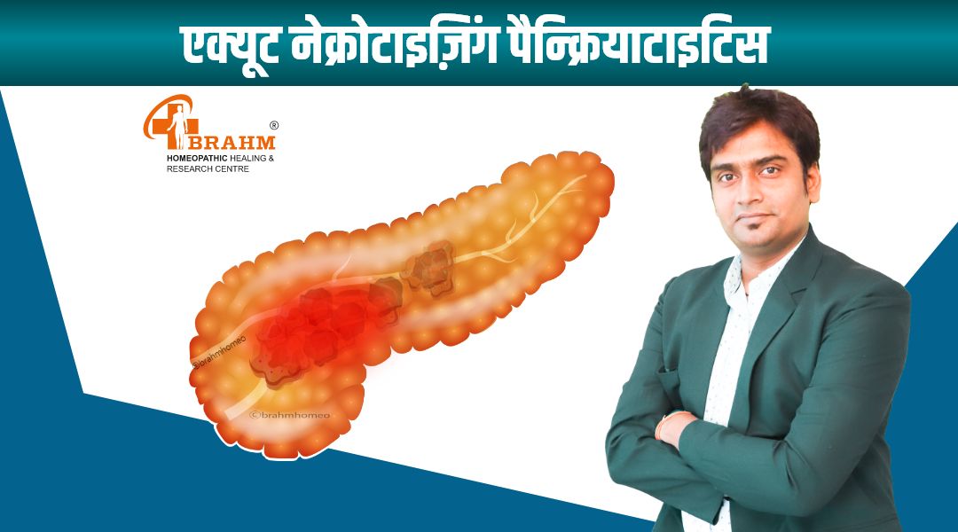 Acute Necrotizing pancreas treatment in hindi