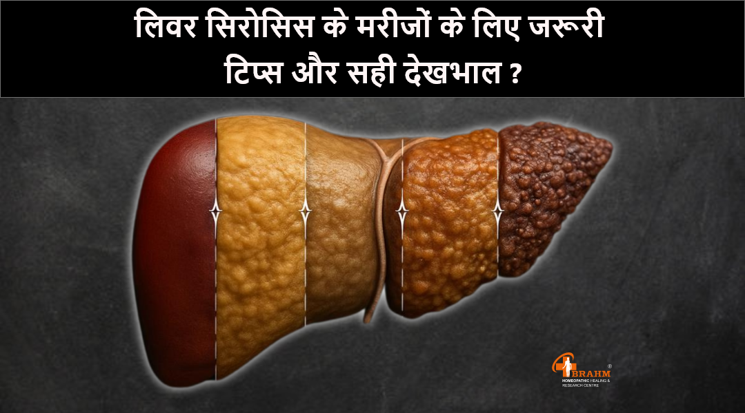 liver cirrhosis treatment in homeopathy